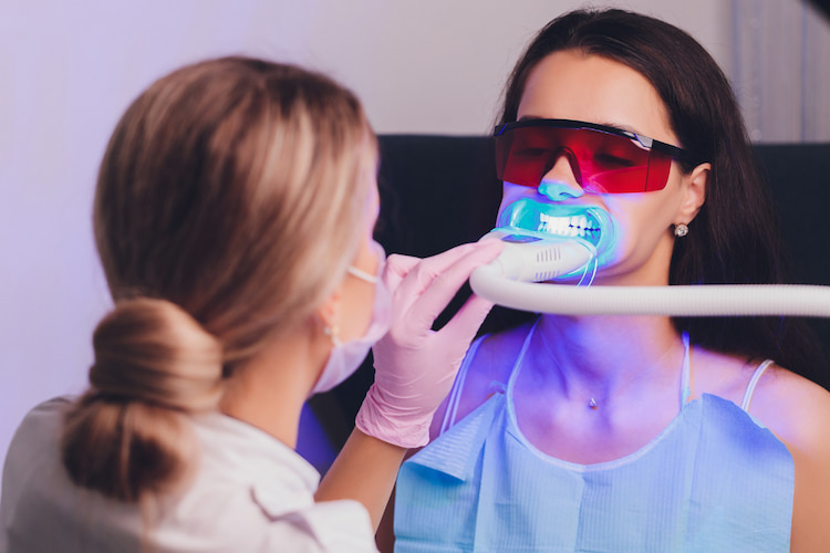 Key Benefits of Professional Teeth Whitening
