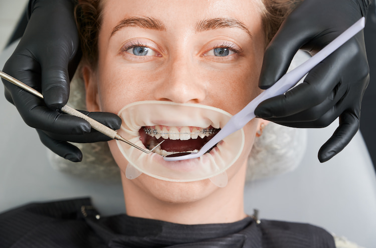 Restorative Dentistry