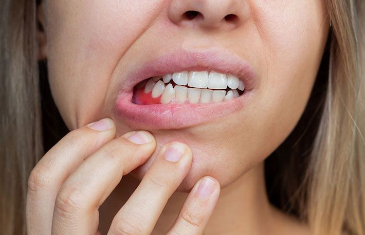 poor oral hygiene