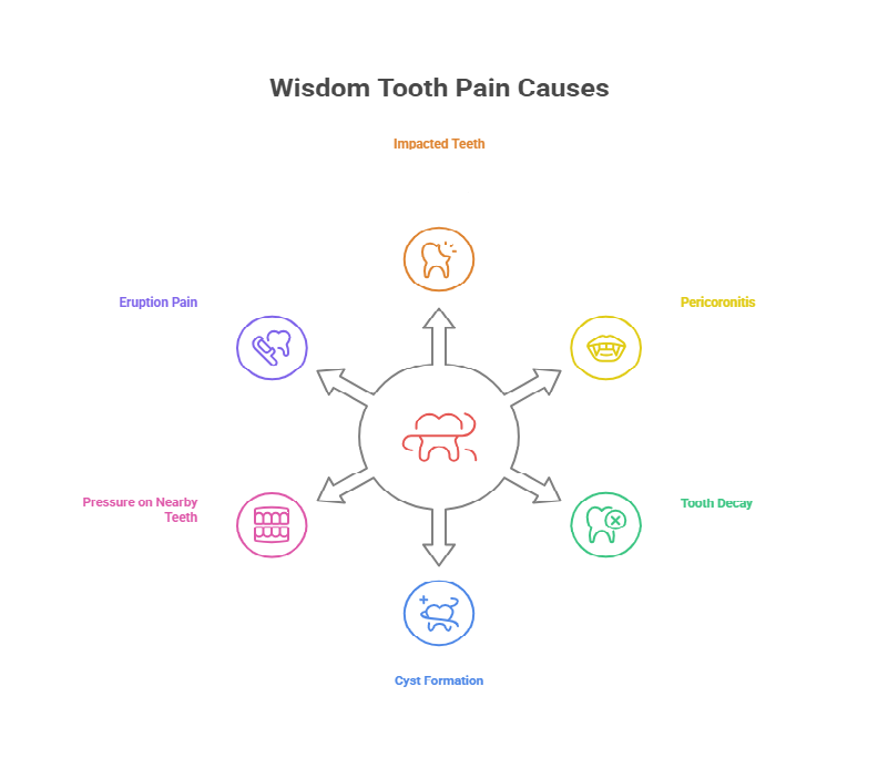 Six Causes of Wisdom Tooth Pain