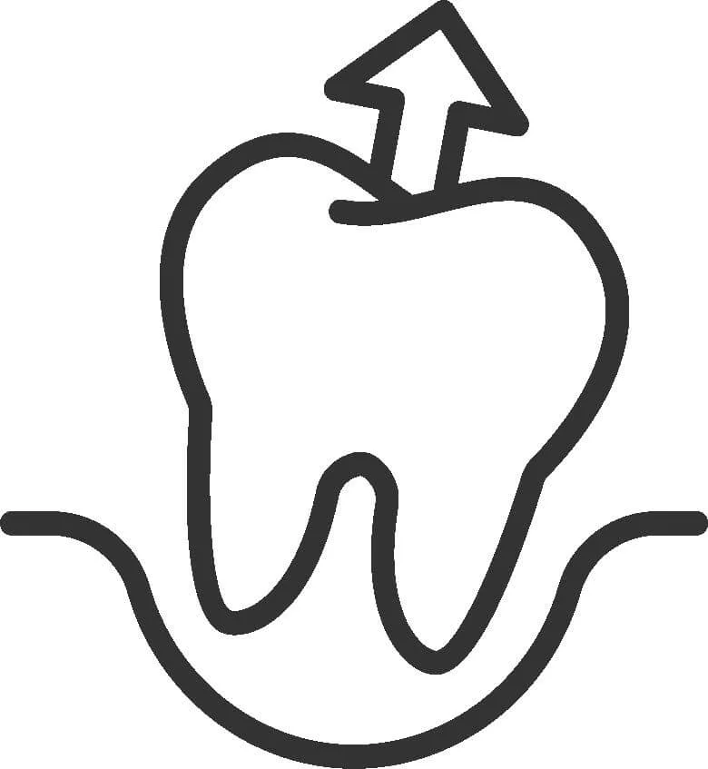 wisdom teeth removal