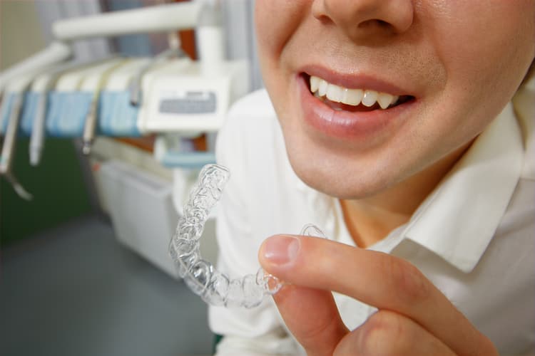 Comparison Between Invisalign and Braces