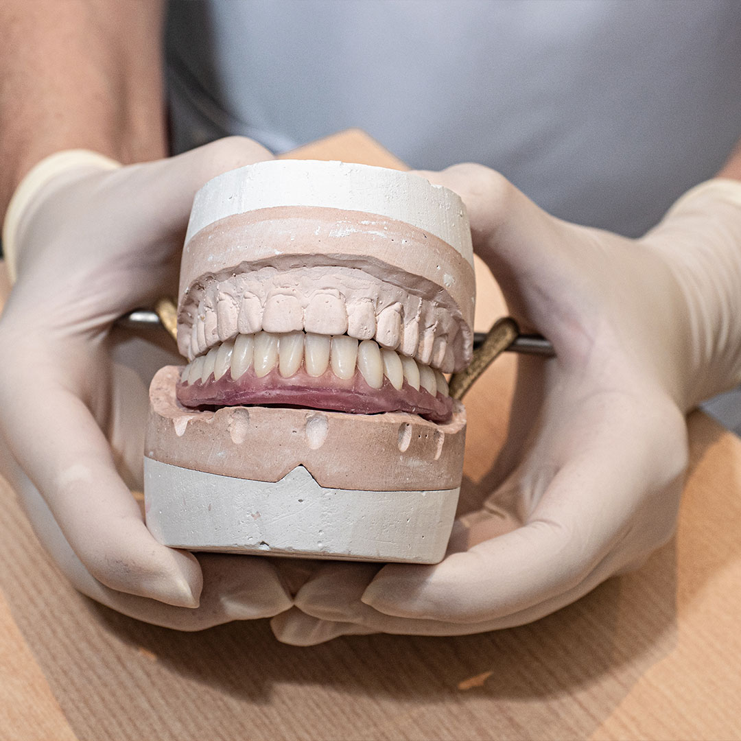 Free Denture Relines for Refugees